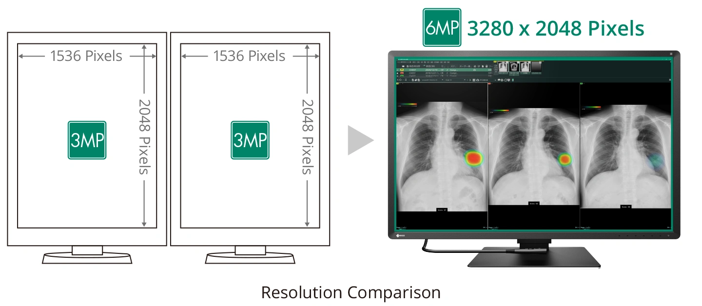 Multi Modality Capability with 6MP Resolution en