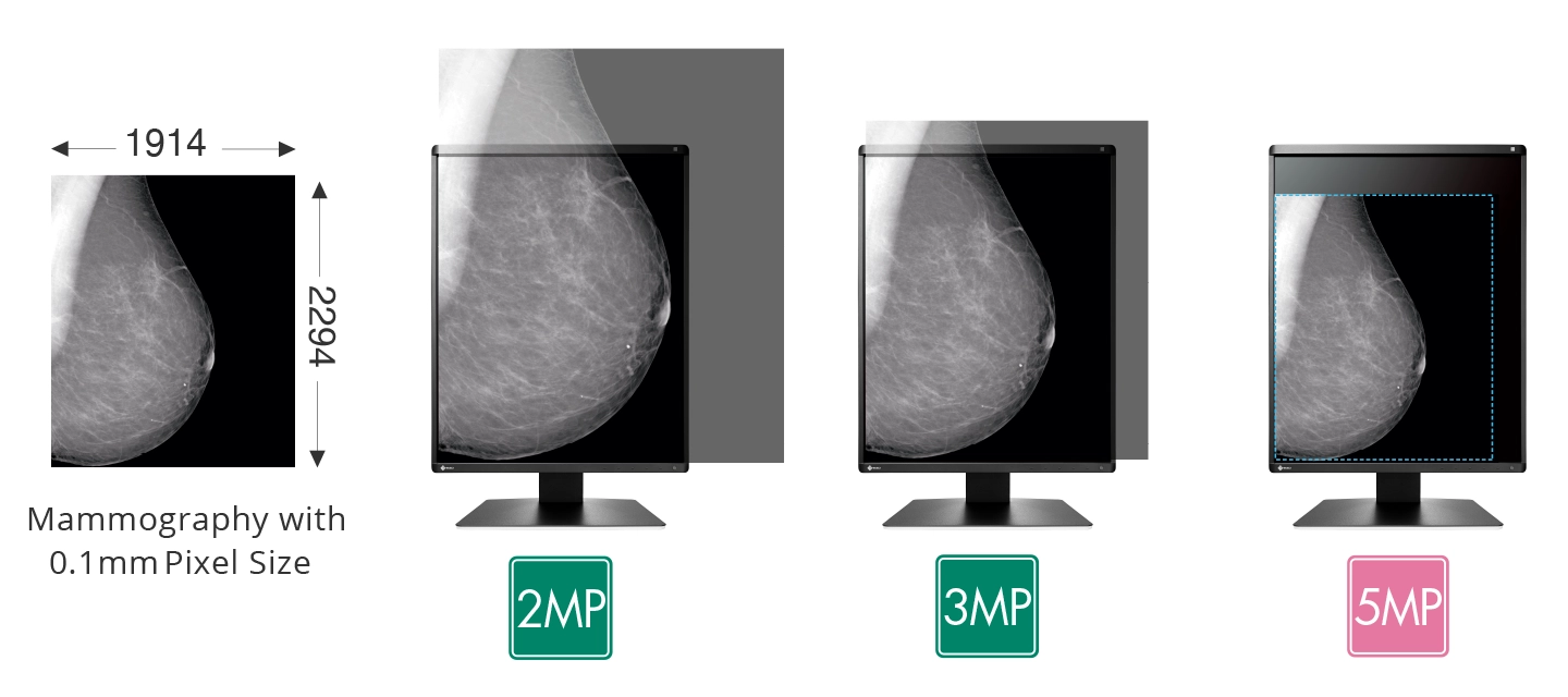 5 Megapixels for High Definition Display