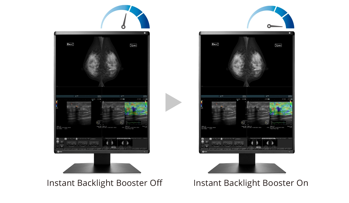 Boost Images for Easy Viewing