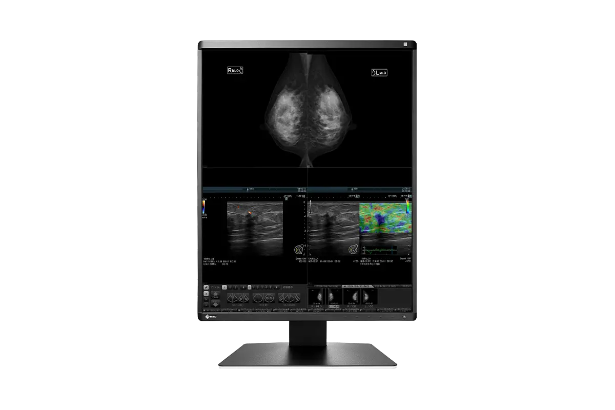 EIZO | RadiForce RX570