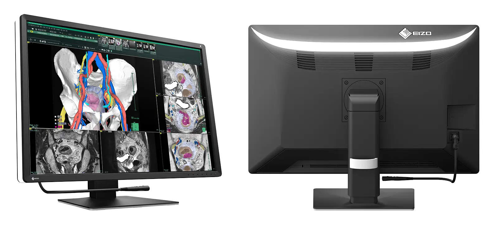 RadiForce RX670